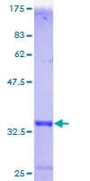 Human MT1F Protein (Recombinant GST)