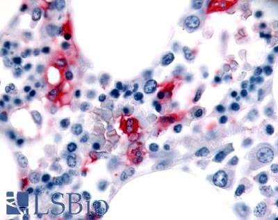 IHC-plus™ MST1R / RON Antibody (Internal)