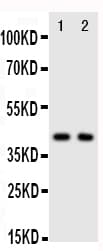 CXCR5 Antibody (aa358-372)