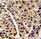 ENO3 / Enolase 3 Antibody (aa237-264)