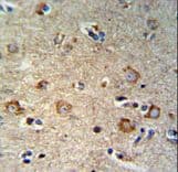 Polyclonal Rabbit anti-Human SETD6 Antibody (aa310-338, IHC, WB)