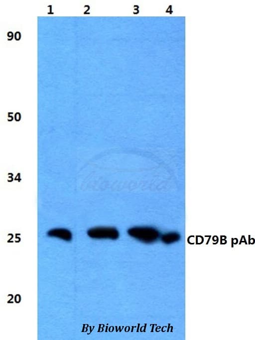 Polyclonal Rabbit anti-Human CD79B / CD79 Beta Antibody (IHC, WB)