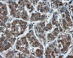 Monoclonal Mouse anti-Human NPR3 Antibody (clone OTI11B6, IHC, IF, WB)