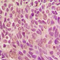 Polyclonal Rabbit anti-Human SMAD1 Antibody (phospho-Ser187, IHC, WB)