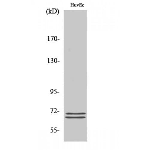 Polyclonal Rabbit anti-Human BLNK Antibody (40-120 aa, IHC, WB)