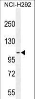MUC3B Antibody (aa866-895)