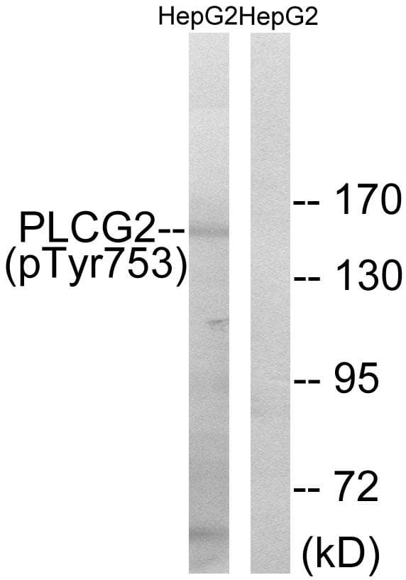 PLCG2 / PLC Gamma 2 Antibody (phospho-Tyr753)