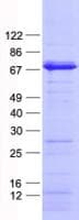 Human PEA3 / ETV4 Protein (Recombinant His, N-Terminal)