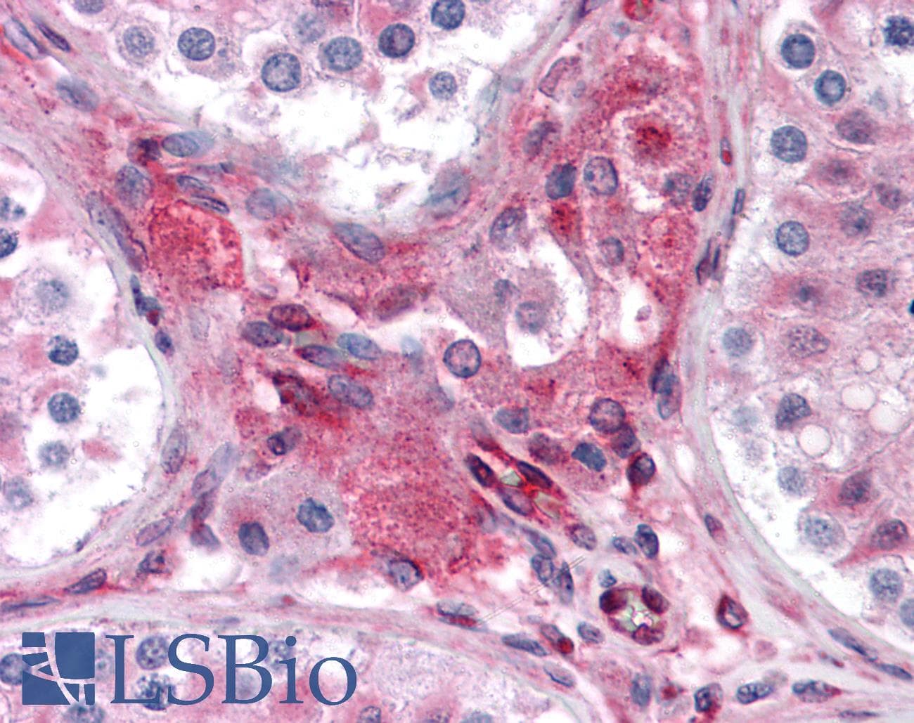 IHC-plus™ PTCHD2 Antibody