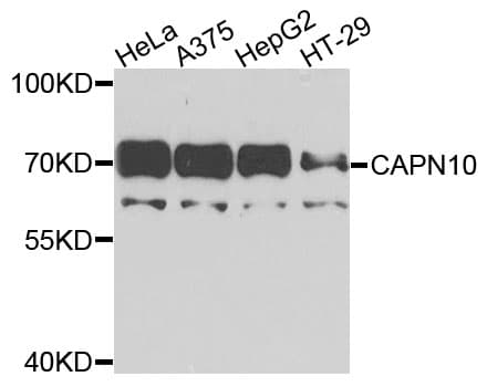 CAPN10 / Calpain 10 Antibody (AP)