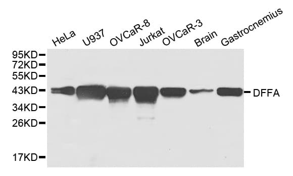 DFFA / ICAD / DFF45 Antibody