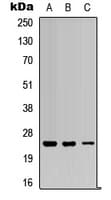 RAB5C Antibody (Internal)