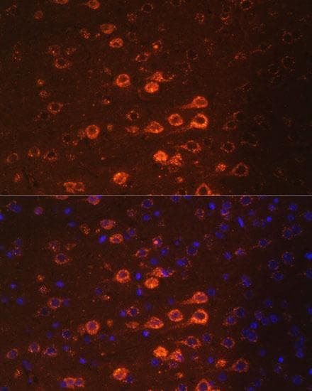 NEFM / NF-M Antibody