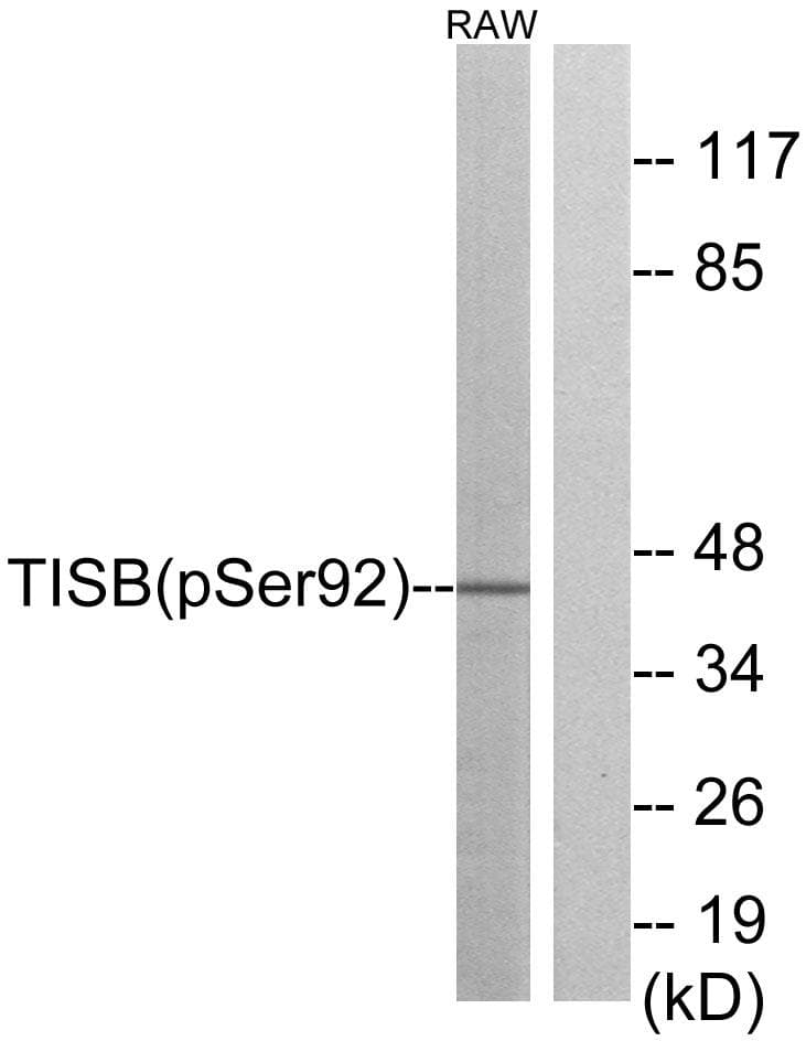 ZFP36L1 Antibody (phospho-Ser92)