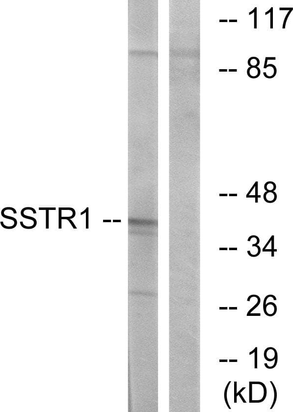 SSTR1 Antibody