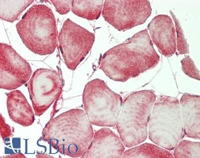 IHC-plus™ Polyclonal Rabbit anti-Human PALLD / Palladin Antibody (Internal, IHC, WB)