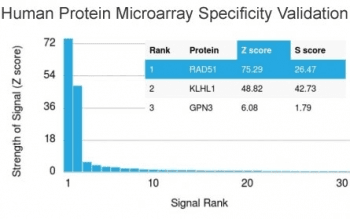 RAD51 / RECA Antibody (clone RAD51/2701)