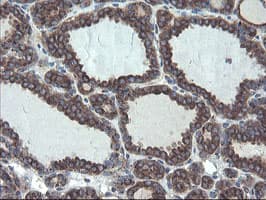 GCP60 / ACBD3 Antibody (clone OTI1B5)