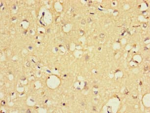 Polyclonal Rabbit anti-Human EXO1 Antibody