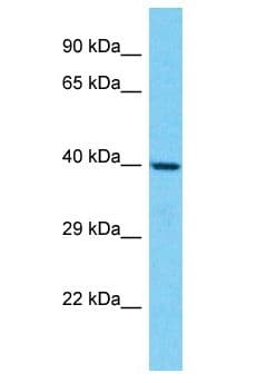 OR6C6 Antibody (aa212-261)