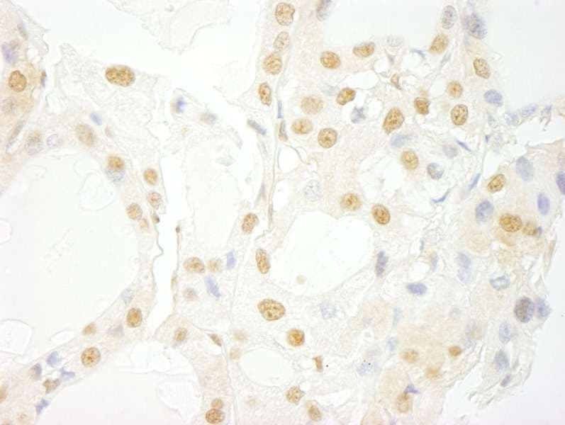 PRPF4B Antibody (aa1-50)