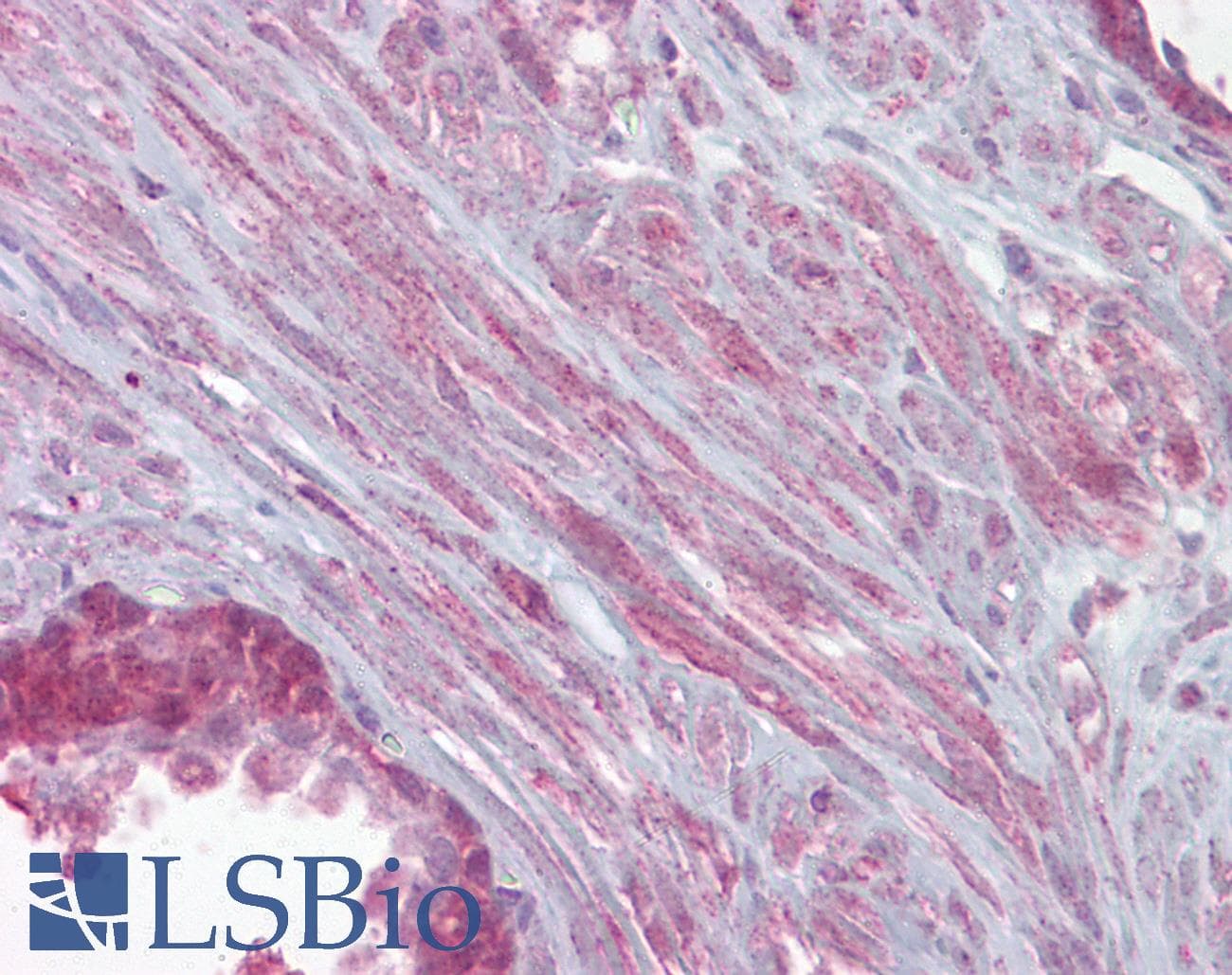 KCNMA1 / BK Antibody (aa1080-1129)