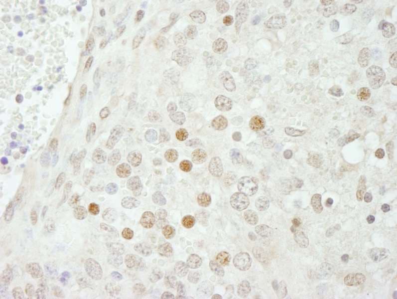 Polyclonal Rabbit anti-Human SMARCB1 / INI1 Antibody (aa75-125, IHC)