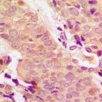 Polyclonal Rabbit anti-Human STAT5 A+B Antibody (phospho-Tyr694/Tyr699, IHC, WB)