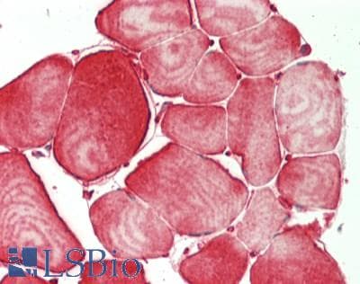 IHC-plus™ Polyclonal Rabbit anti-Human MAPK7 / ERK5 Antibody (aa475-525, IHC)