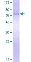 Human SFTPD / Surfactant Protein D (Recombinant GST)