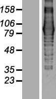 EVI5L Protein (Over-Expression Lysate Myc-DDK (Flag))