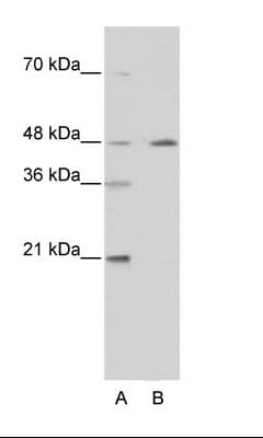 COUP-TFII / NR2F2 Antibody (aa141-190, FITC)
