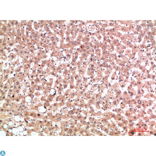 EPG5 / KIAA1632 Antibody