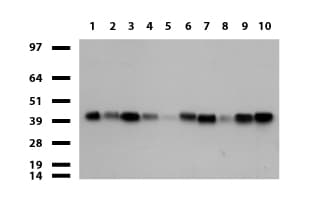 Monoclonal Mouse anti-Human CD32A Antibody (clone UMAB60, Carrier-free, IHC, WB)