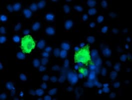 SHPK / CARKL Antibody (clone OTI1D2)