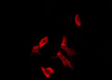 OR11H1+2+12 Antibody