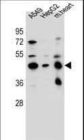 LRRC28 Antibody (aa314-342)