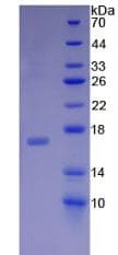 Rat MDK / Midkine Protein (Recombinant His, N-Terminal)