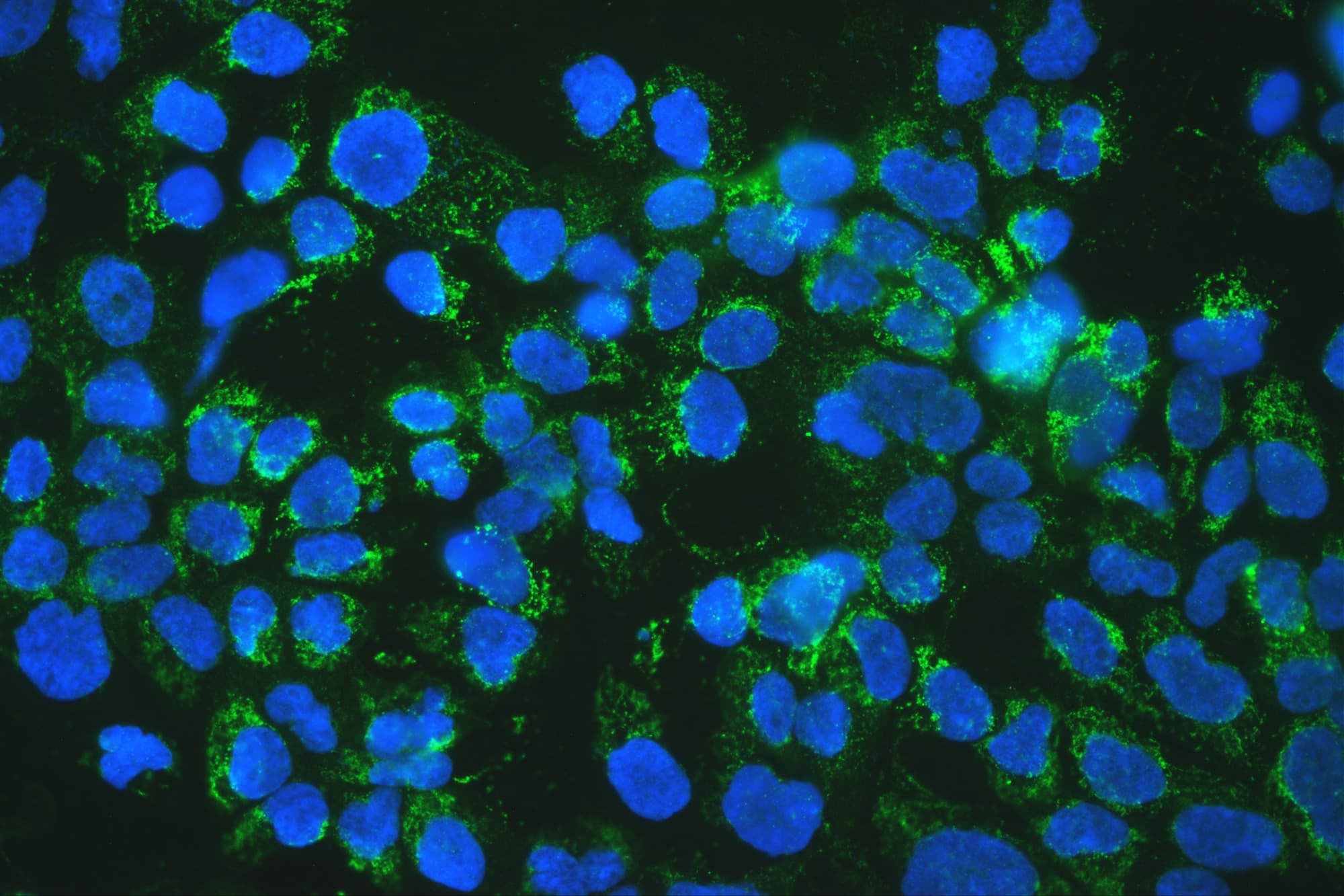 MtTFA / TFAM Antibody (aa214-241)