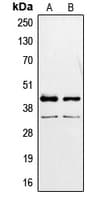 PAX2 Antibody (Internal)