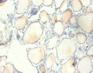 RPS13 / Ribosomal Protein S13 Antibody