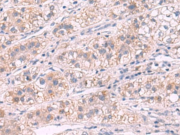 Polyclonal Rabbit anti-Human G6PC / Glucose-6-Phosphatase Antibody (IHC)