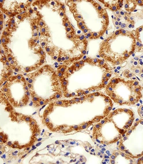 Polyclonal Rabbit anti-Human ADRA1D / Adrenoceptor alpha 1D Antibody (aa1-30, IHC, WB)