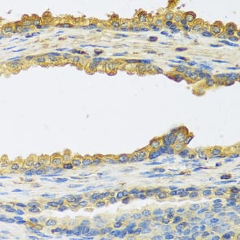 TSHB / TSH-Beta Antibody