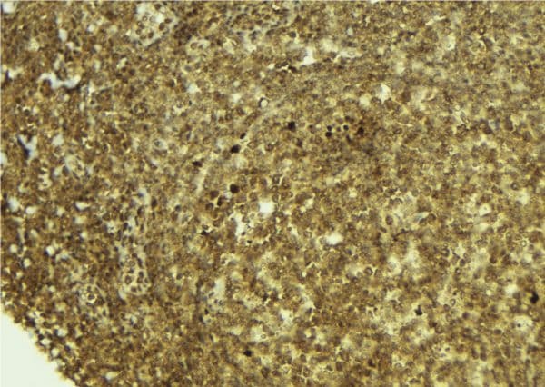PSPC1 Antibody