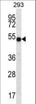 ATP6V1B1 Antibody (aa472-501)
