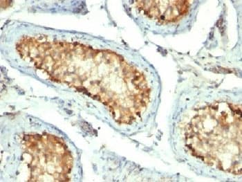 HSPD1 / HSP60 Antibody (clone GROEL/730)