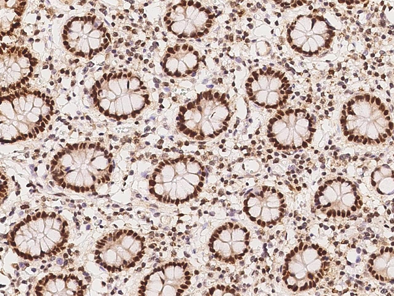 Polyclonal Rabbit anti-Human RFC4 Antibody (IHC, IF, WB)