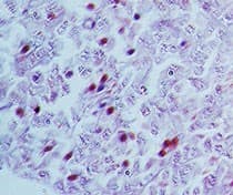 NR5A2 / LRH-1 Antibody (aa140-190)