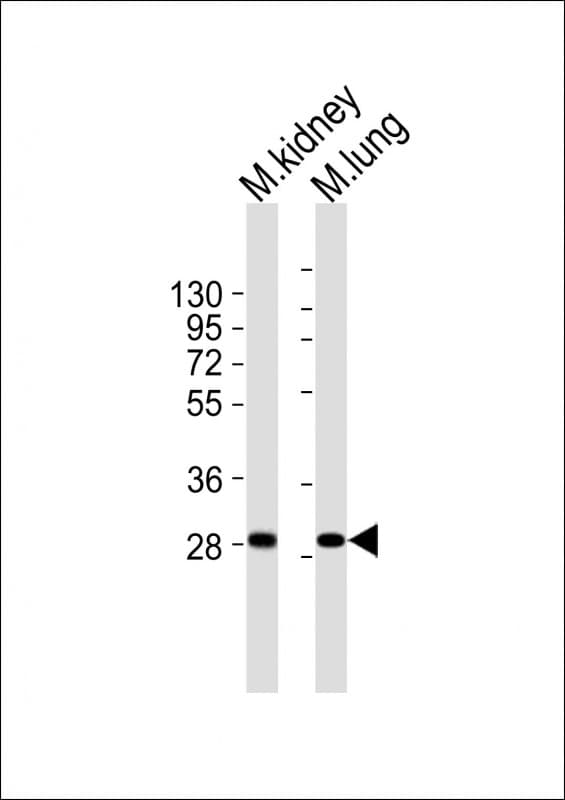 HOXB4 Antibody (aa218-252)